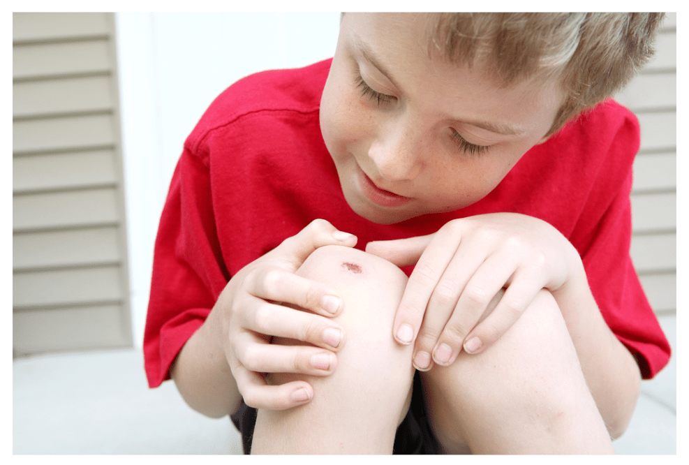 Young boy in red t-shirt looking a a scab on his knee with great interest