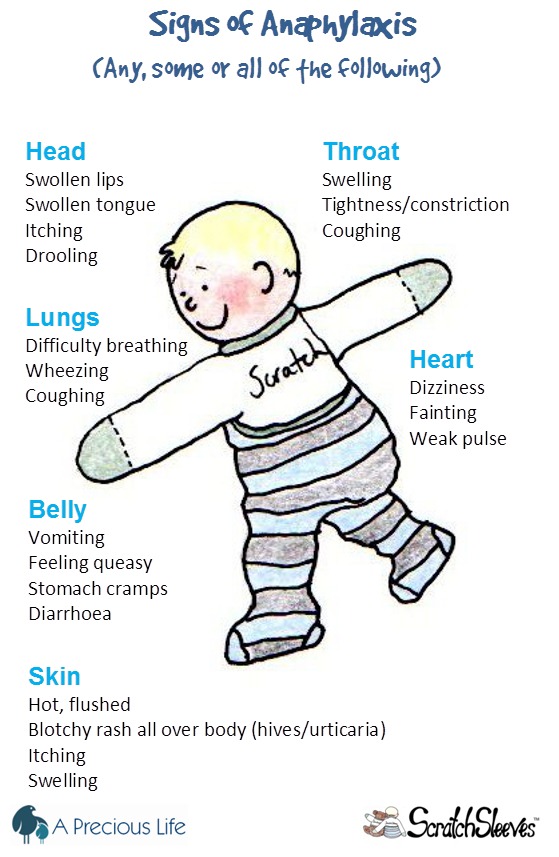 line drawing of baby showing key symptoms of anaphylaxis