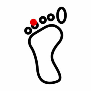Diagram showing the location of the Zuqiooyin acupressure point on the tip of the fourth toe