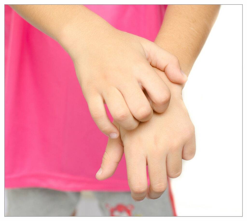 close-up of young girls hands. She is scratching the back on one hand with the other. There is no obvious eczema on her hands (but they do look dry).