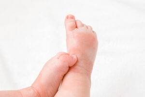 Close up of baby's legs and feet showing eczema patches and one foot scratching the other ankle.