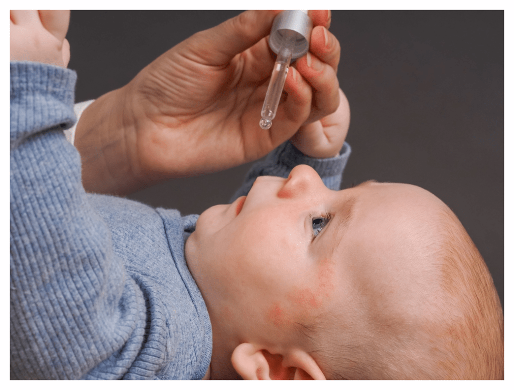 Baby boy with active eczema on his face lying on his back while a parent give him a homoeopathic remedy using a dropper.