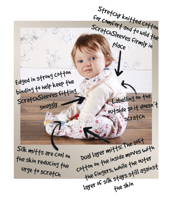 Baby girl with blue eyes and red blonde hair wearing ScratchSleeves eczema mittens over a flower print sleep suit. Annotated to show how these eczema mitts work.