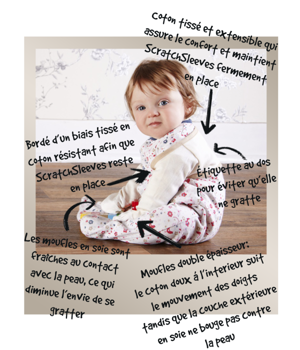 Petite fille aux yeux bleus et aux cheveux blonds roux portant des mitaines anti-eczéma ScratchSleeves sur une combinaison de nuit à imprimé fleuri. Annoté pour montrer comment fonctionnent ces gants contre l'eczéma.