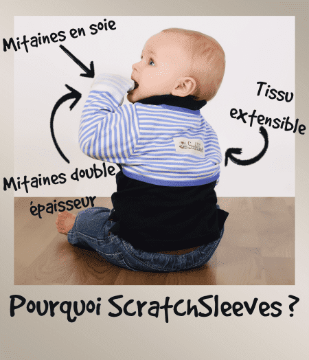 Tout-petit garçon portant des mitaines anti-rayures ScratchSleeves bleues et blanches, annotées pour montrer comment elles agissent pour réduire les rayures causées par l'eczéma
