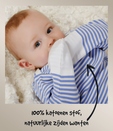 Babyjongen met blauw-wit gestreepte ScratchSleeves-pyjama's en witte geïntegreerde zijden wanten. Geannoteerd om te laten zien hoe de wanten het krabben door eczeem stoppen